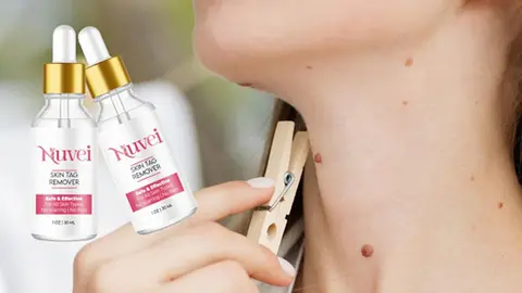 Nuvei Skin Tag Remover Shocking Price & Benefits On Male & Female